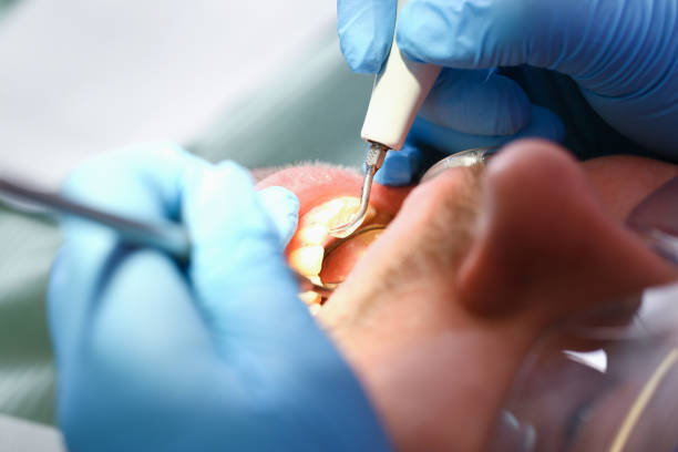 Best 24-Hour Emergency Dentist in Park Layne, OH